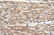 ARP48936_P050 - PNPLA3 / ADPN