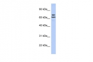 ARP48971_P050 - GTDC2 / AGO61