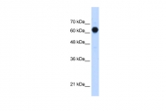 ARP48972_T100 - GTDC2 / AGO61