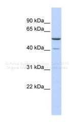 ARP49066_P050 - METT5D1