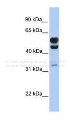 ARP49111_P050 - EOGT / AER61