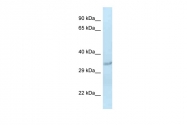 ARP49129_P050 - SULT1C2 / SULT1C1