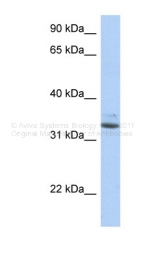 ARP49134_P050 - SULT1A1