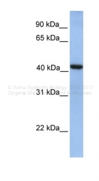 ARP49209_P050 - GMPPA