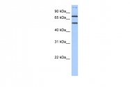 ARP49437_P050 - Delta-like protein 4 / DLL4