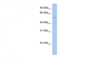 ARP49445_P050 - ALG1 / HMAT1