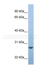 ARP49475_P050 - C15orf24
