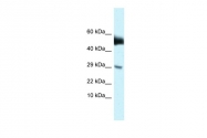 ARP49527_P050 - AMHR2