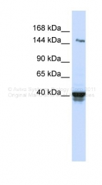 ARP49567_P050 - IGSF9
