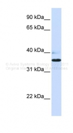 ARP49606_P050 - B3GALT1