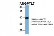 ARP49626_P050 - ANGPTL7