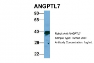 ARP49626_P050 - ANGPTL7
