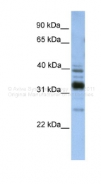 ARP49631_P050 - TXNDC13 / TMX4