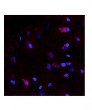 ARP49645_P050 - Netrin-4
