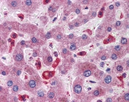 ARP49664_P050 - SIGIRR / TIR8