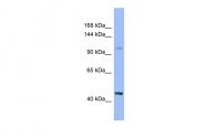 ARP49702_P050 - Xylosyltransferase 2 / XYLT2