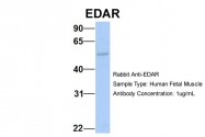ARP49706_P050 - EDAR