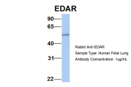 ARP49706_P050 - EDAR