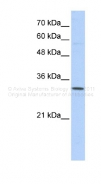 ARP49750_P050 - Sideroflexin-1 (SFXN1)