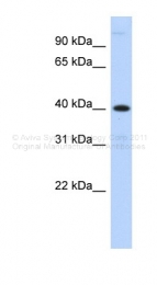 ARP49781_P050 - Metallophosphoesterase 1