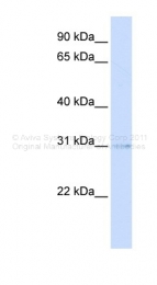 ARP49798_P050 - PVRIG