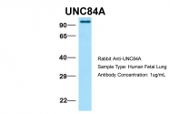 ARP49929_P050 - UNC84A