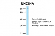 ARP49929_P050 - UNC84A