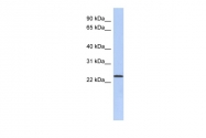 ARP49935_P050 - ULBP1 / NKG2D ligand 1