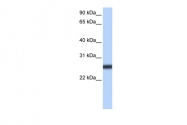 ARP49958_P050 - TMPRSS5 / Spinesin