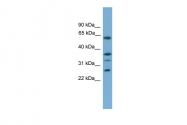 ARP49974_P050 - Apolipoprotein L2 / APOL2