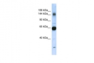 ARP50265_P050 - Collagen type XI alpha 2 chain