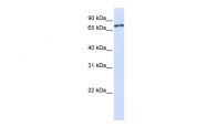 ARP50294_P050 - UNC5A