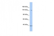 ARP50467_P050 - RB1CC1