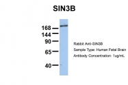 ARP50589_P050 - SIN3B