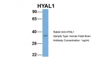 ARP50812_P050 - HYAL1 / Hyaluronidase-1