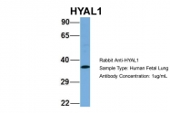 ARP50812_P050 - HYAL1 / Hyaluronidase-1