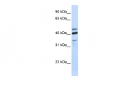 ARP50813_P050 - HYAL1 / Hyaluronidase-1