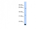 ARP50912_P050 - ARID5A / MRF1