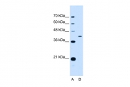 ARP51158_P050 - Apolipoprotein H / Apo H