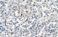 ARP51161_T100 - CDR2