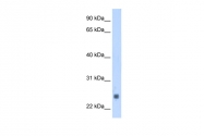 ARP51270_T100 - Fast skeletal muscle Troponin I