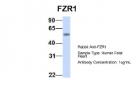 ARP51279_P050 - FZR1 / CDH1