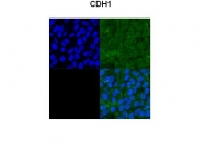 ARP51289_P050 - CD324 / Cadherin-1