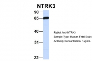 ARP51318_P050 - TrkC