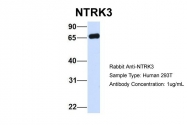 ARP51318_P050 - TrkC