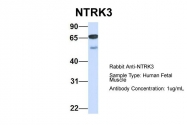 ARP51318_P050 - TrkC