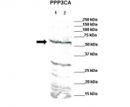 ARP51337_P050 - PPP3CA / Calcineurin A