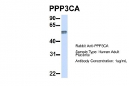 ARP51338_P050 - PPP3CA / Calcineurin A