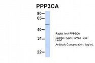 ARP51338_P050 - PPP3CA / Calcineurin A