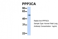 ARP51338_P050 - PPP3CA / Calcineurin A